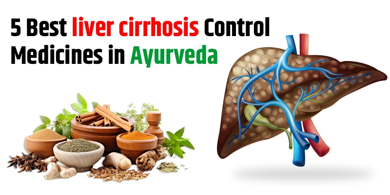 liver-cirrhosis-control-medicines-in-ayurveda